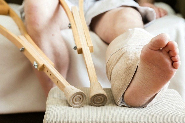 bone fractures