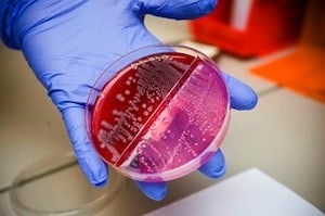 E. Coli