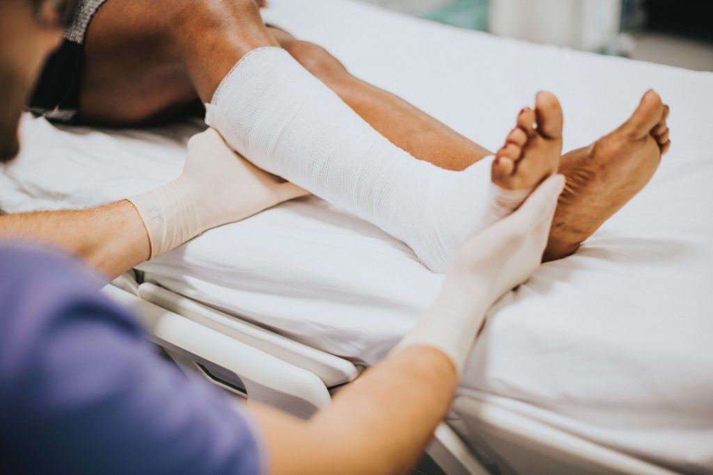 impaction fracture