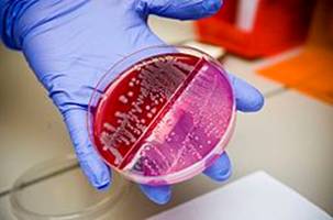 Noro Virus